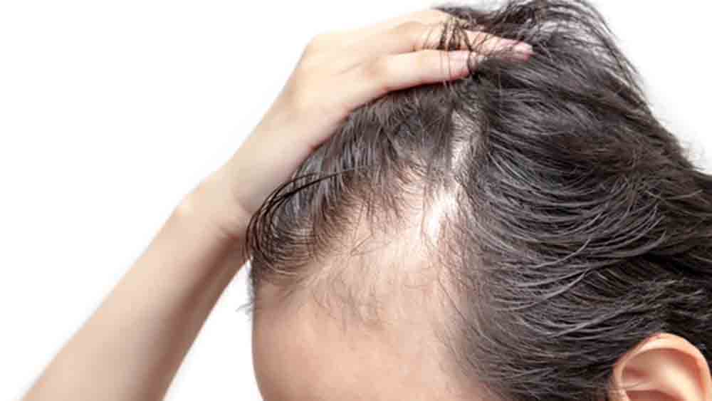 シャンプートップ