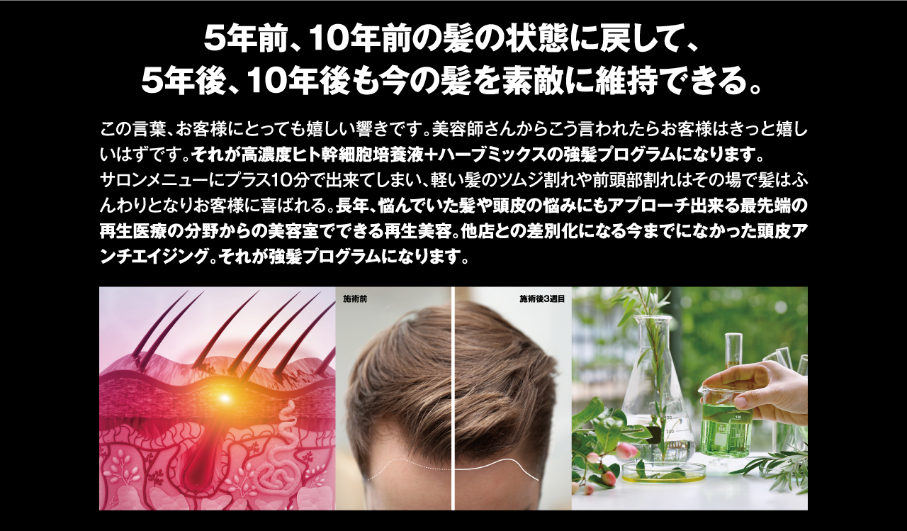 5年前、10年前の髪の状態に戻して、5年後、10年後も今の髪を素敵に維持できる。　この言葉、お客様にとっても嬉しい響きです。美容師さんからこう言われたらお客様はきっと嬉しいはずです。それが高濃度ヒト幹細胞培養液＋ハーブミックスの強髪プログラムになります。サロンメニューにプラス10分で出来てしまい、軽い髪のツムジ割れや前頭部割れはその場で髪はふんわりとなりお客様に喜ばれる。長年、悩んでいた髪や頭皮の悩みにもアプローチ出来る最先端の再生医療の分野からの美容室でできる再生美容。他店との差別化になる今までになかった頭皮アンチエイジング。それが強髪プログラムになります。